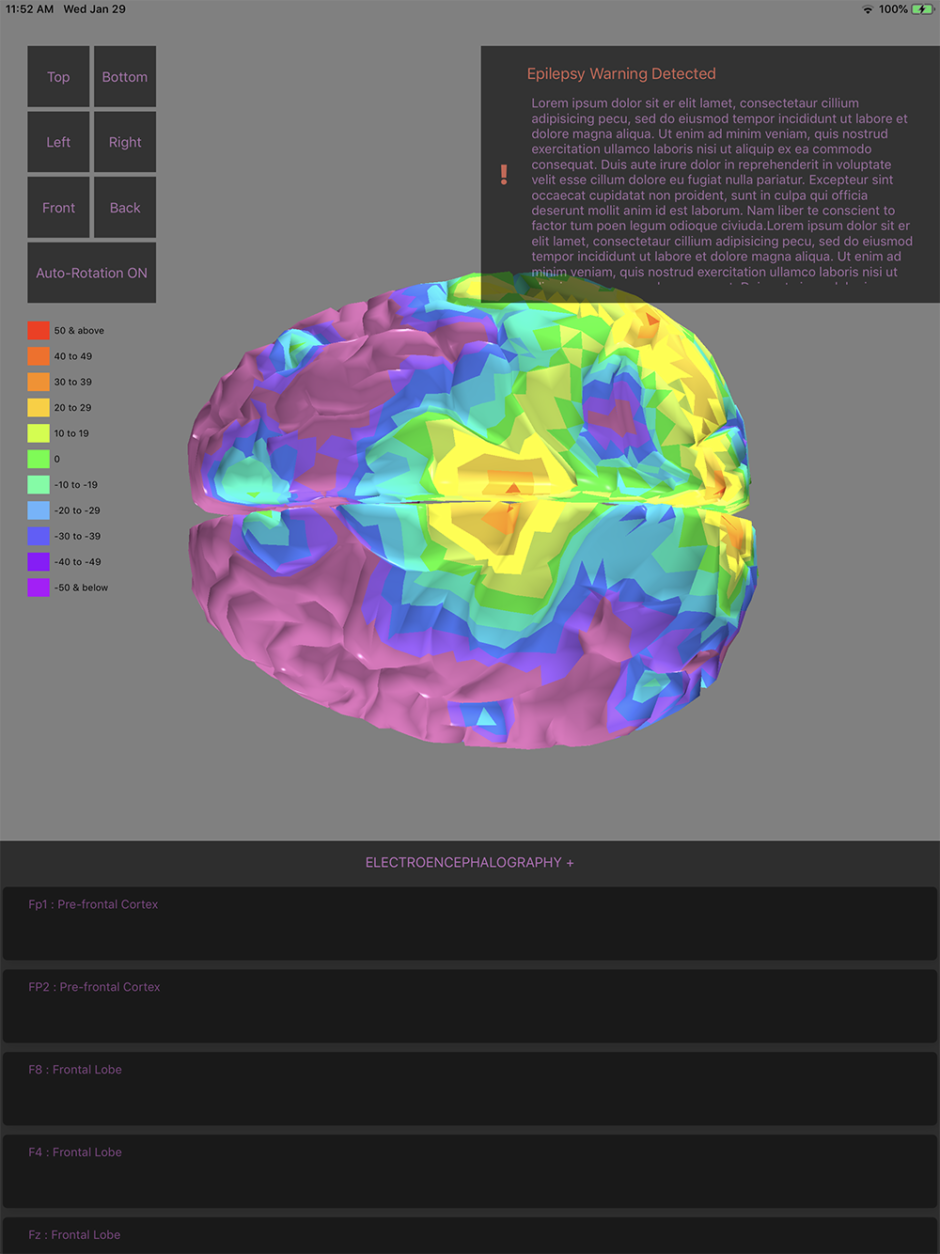 EEG Data Model Screenshot on iPad